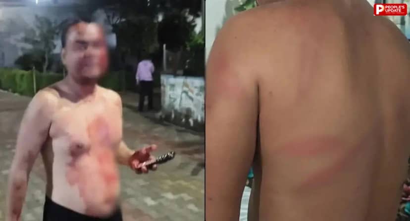 शहडोल: अधिवक्ता के साथ पुलिसकर्मियों ने की मारपीट, सिर फटा-कान जख्मी
