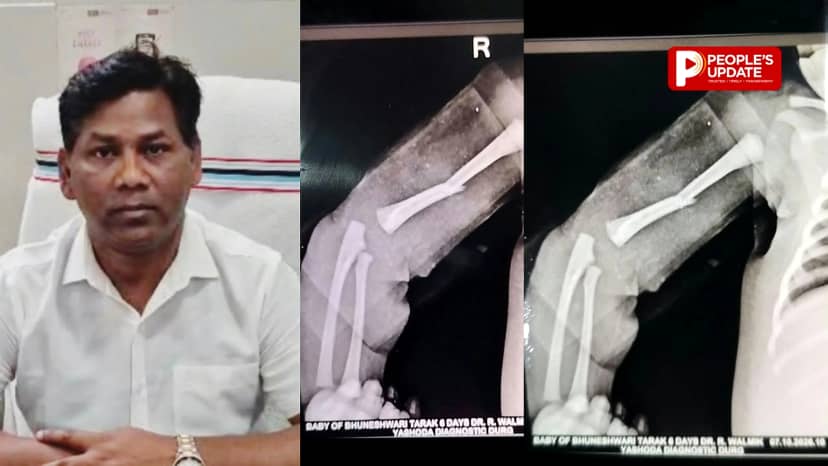 दुर्ग जिला अस्पताल में प्रसव के दौरान लापरवाही का आरोप, नवजात की हालत गंभीर,जांच टीम गठित