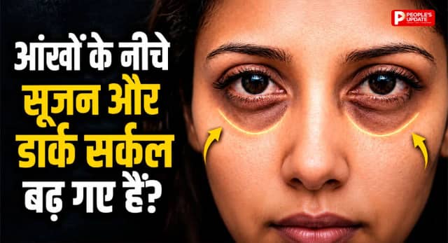 नींद पूरी फिर भी डार्क सर्कल्स? चेहरा दे रहा गंभीर बीमारी का संकेत, जानिए असली कारण