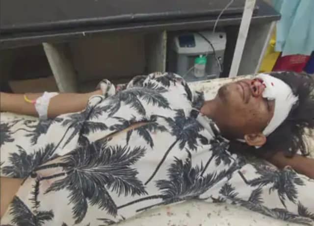 आष्टा में खड़े ट्रक से भिड़ी तेज रफ्तार बोलेरो पिकअप, लिफ्ट लेकर बैठे व्यक्ति की मौत, ड्राइवर गंभीर घायल