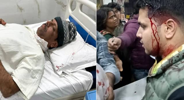 इंदौर में मिठाई देने से इनकार किया तो बदमाशों ने दुकान संचालक पर चाकू से किया हमला 
