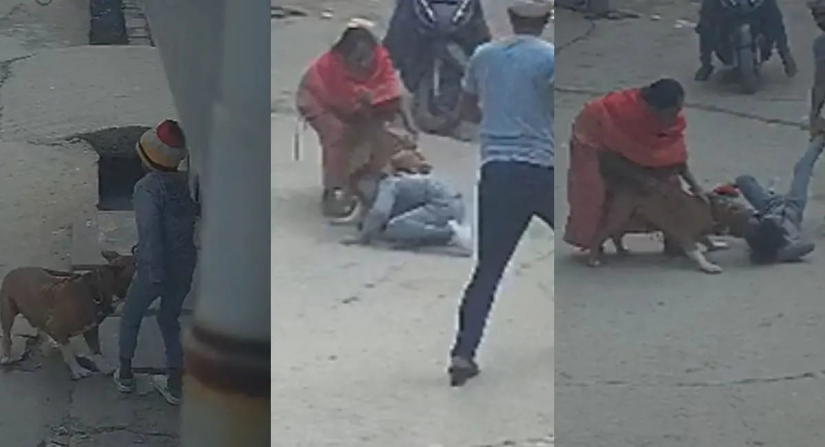 पिटबुल ने कान काटकर किया अलग, घर के बाहर खेल रहा था 6 साल का बच्चा; VIDEO वायरल