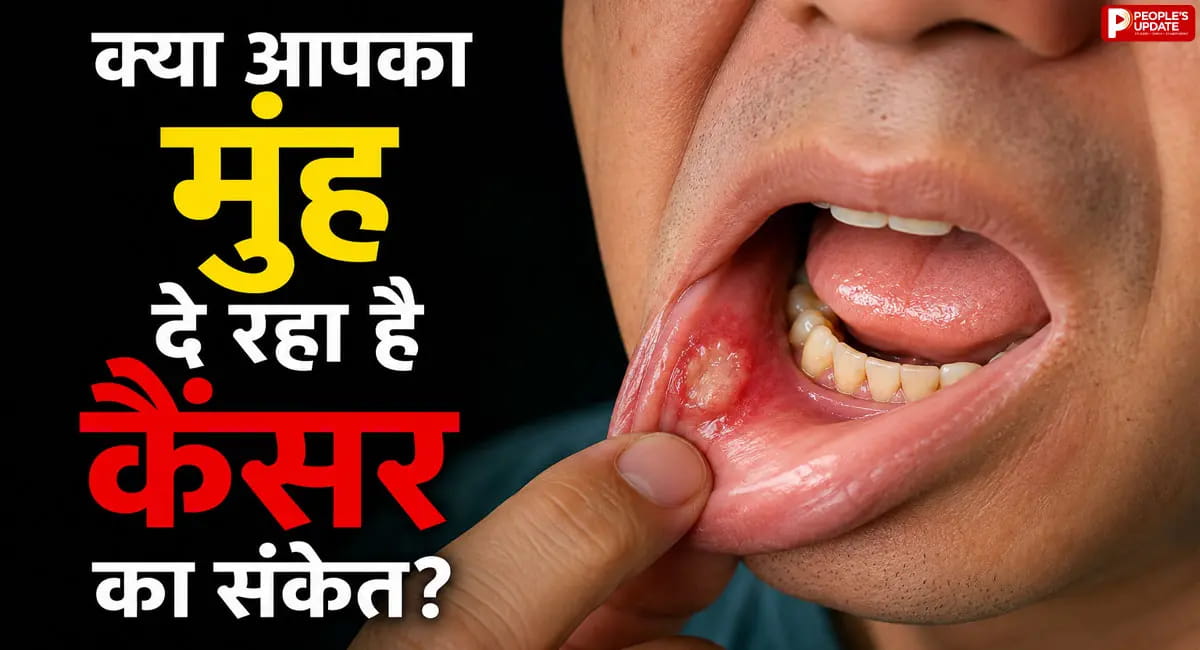 तंबाकू खाने वालों के लिए एक्सपर्ट की बड़ी चेतावनी, जानिए ओरल कैंसर के शुरुआती लक्षण