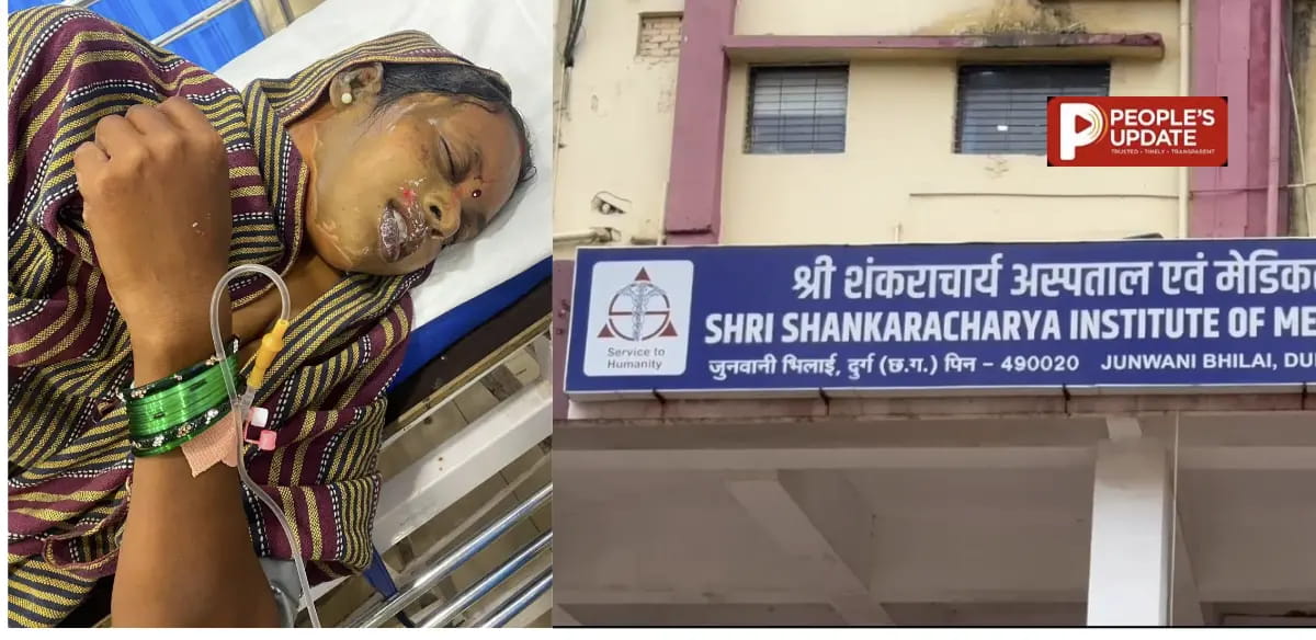 कांवड़ यात्रा में महिला पर एसिड अटैक, दो बच्चे भी झुलसे