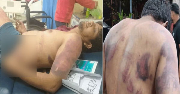 Bhopal News : चोरी के शक में युवक को कमरे में बंद कर 12 घंटे तक पीटा, कबाड़ कारोबारियों पर लगा आरोप