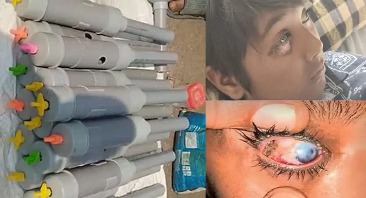 भोपाल में बैन हुई ‘आंख फोड़ू कैल्शियम कार्बाइड गन’, दिवाली पर 300 लोगों की आंखों को पहुंचा नुकसान; अब सख्त हुआ प्रशासन