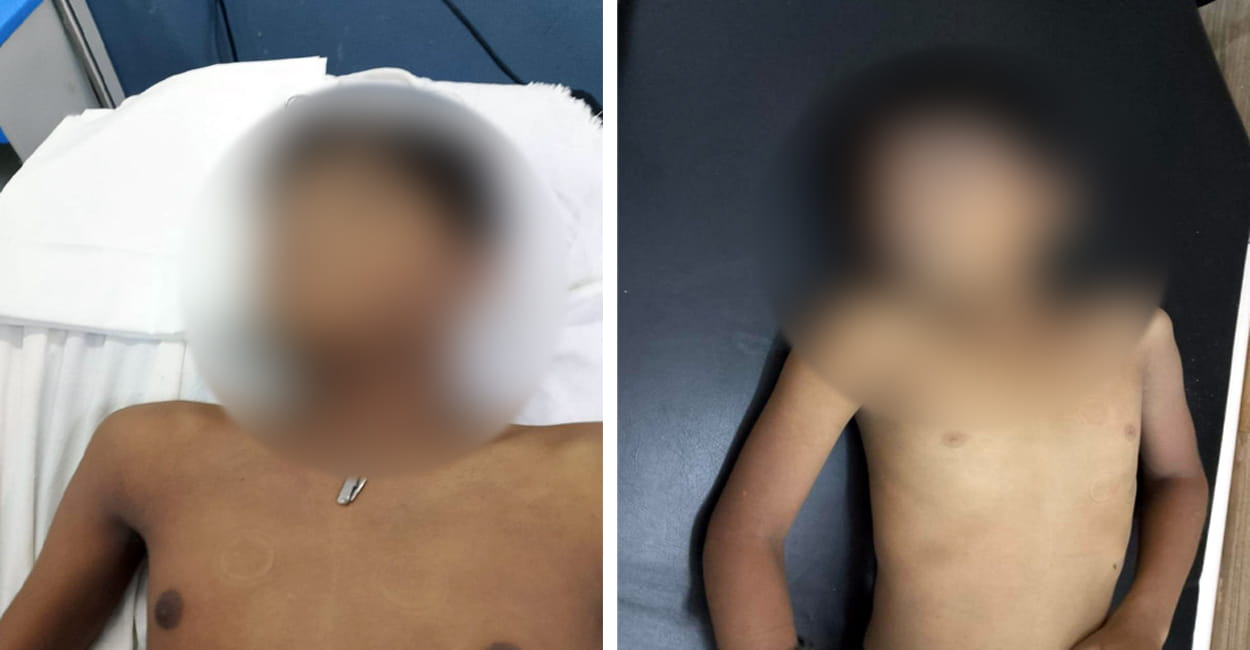पानी से भरे गड्ढे में डूबकर दो बच्चों की मौत- अन्य बिंदुओं पर पुलिस जांच में जुटी 