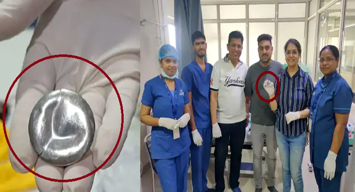 1.5 इंच का ढक्कन गले में फंसा - डॉक्टरों की तत्परता से टला बड़ा हादसा