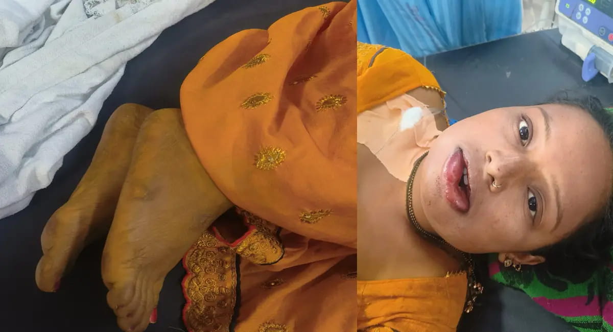 मंडप सजने से पहले उठी दुल्हन की अर्थी