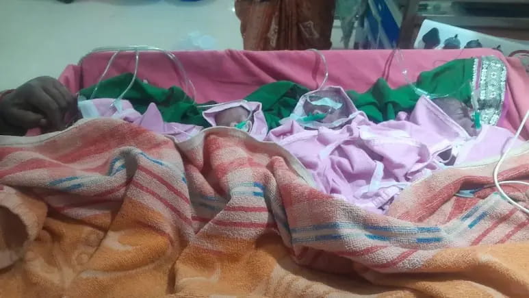 छिंदवाड़ा में महिला ने एक साथ चार बच्चों को दिया जन्म