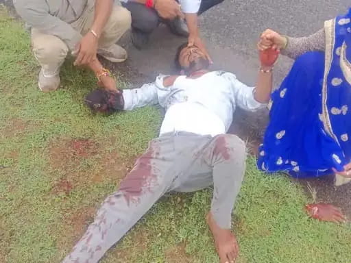 दमोह में सरपंच ने मामूली विवाद में युवक का कुल्हाड़ी से काटा युवक के हाथ का पंजा
