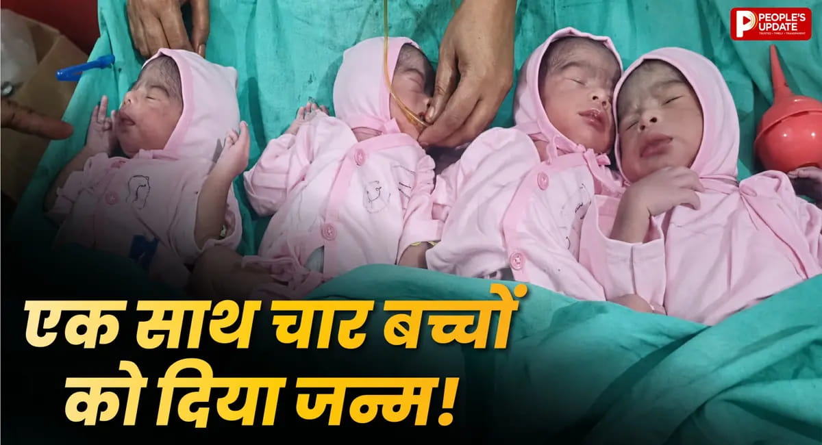 दिखे 3 बच्चे, ऑपरेशन में निकला चौथा… सिवान के डॉक्टर भी रह गए हैरान