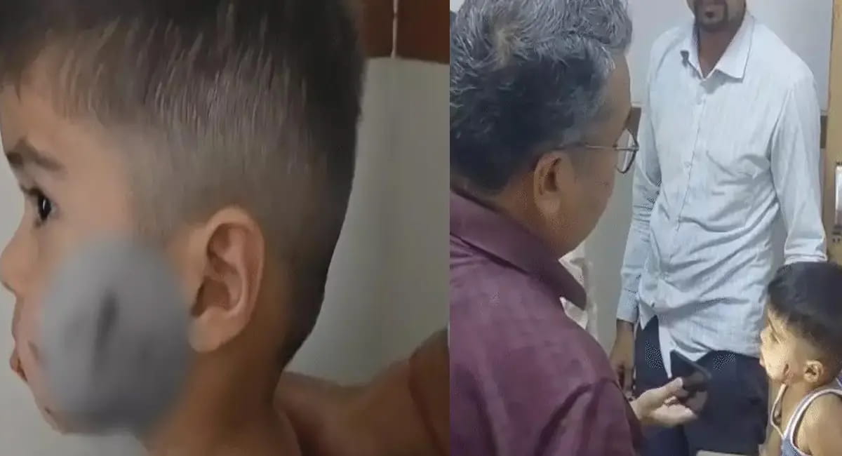 3 साल के मासूम के चेहरे पर काटा; सात दांतों के निशान पड़े