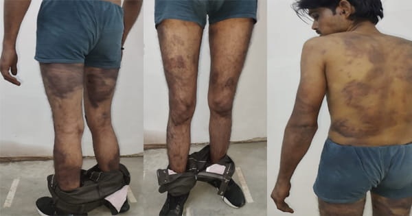 इंदौर में व्यापारी की दरिंदगी, नौकरी छोड़ने पर युवक का किया अपहरण, बेहोश होने तक बेरहमी से पीटा