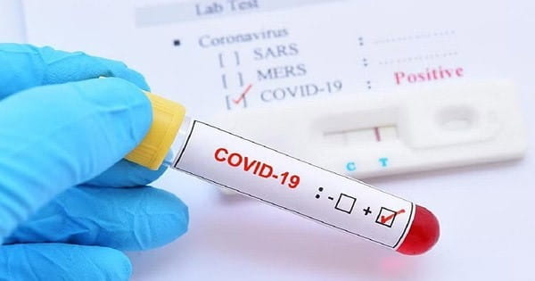 Covid -19 Return : देश में हर दिन सामने आ रहे कोरोना के 500 से ज्यादा मरीज, जानें कितनी है एक्टिव मरीजों की संख्या