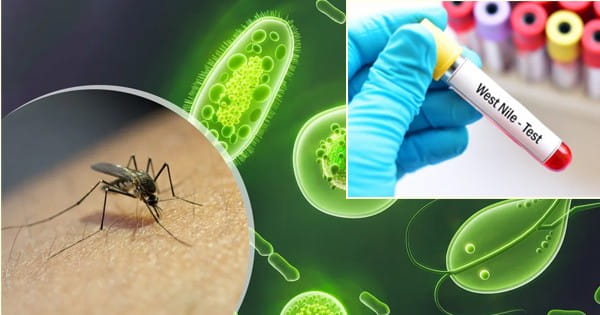 केरल में West Nile Fever का अलर्ट : राज्य में मिले 6 केस, मच्छरों के काटने से फैलती है बीमारी; जानें लक्षण