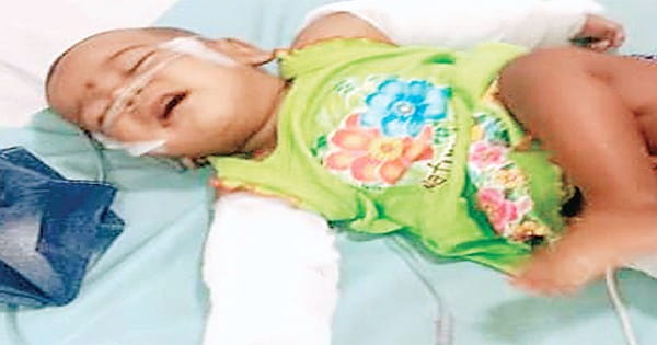 8 माह की बच्ची के तोड़े हाथ, पैर व कमर, जिंदगी की जंग लड़ रही