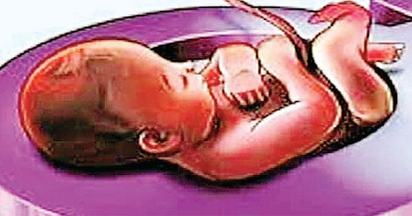 लिंगानुपात : 51 में से 17 जिलों का रेशियो ठीक, दतिया-सतना में सबसे कम बेटियां