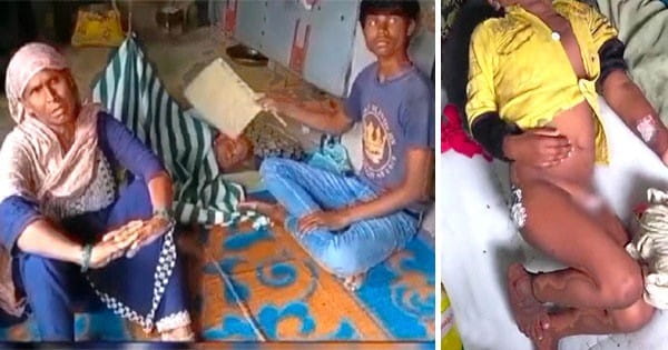 बेड पर कर दी यूरिन तो सौतेली मां ने पार की क्रूरता की हद, मासूम बच्चे को  जगह-जगह चिमटे से दागा, बोली- जितना रोएगा उतना ज्यादा जलाउंगी