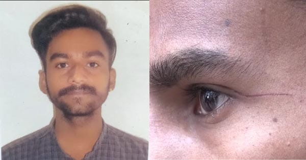 Indore News : पतंग के धागे से युवक का कटा गला, मौत, दोस्त को आंख के पास चोट आई; परिजनों का आरोप- 'प्रतिबंधित चीनी मांझे से गई जान'