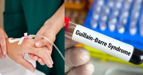 महाराष्ट्र में ‘गुइलेन-बैरे सिंड्रोम’ (GBS) का कहर : अब तक सामने आए 225 केस, 12 लोगों की मौत; वेंटिलेटर पर 15 मरीज