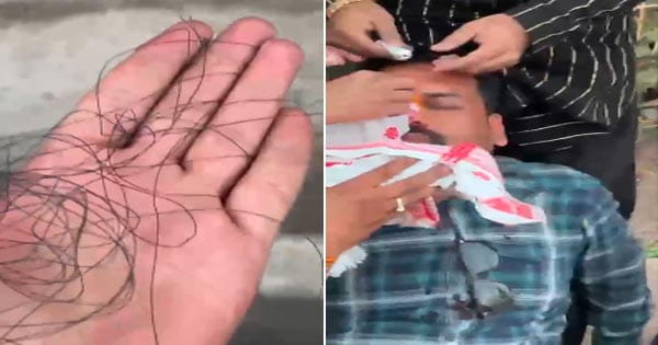 भोपाल : चलती बाइक के सामने अचानक आया चाइनीज मांझा, युवक की कटी नाक, काफी खून बहा, लोगों ने अस्पताल में कराया भर्ती