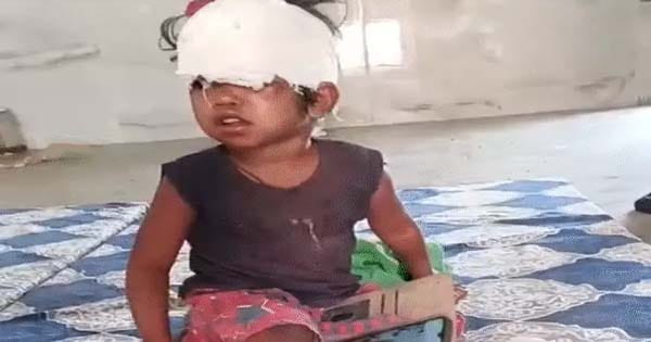कुत्तों के झुंड ने किया 2 साल की बच्ची पर जानलेवा हमला, सिर फाड़ा, परिसर में घसीटा,  मंदिर में खेल रही मासूम