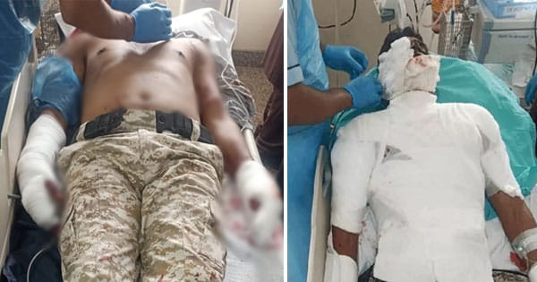 भोपाल की 25वीं बटालियन में मॉक ड्रिल के दौरान ग्रेनेड ब्लास्ट, दो पुलिसकर्मी घायल, एक की हालत नाजुक