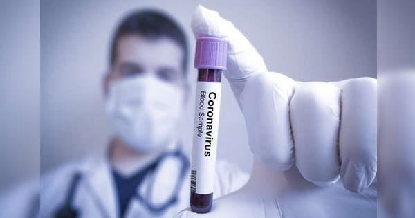 MP Corona Update : प्रदेश में लगातार कम हो रहे कोरोना केस, एक्टिव मरीजों की संख्या 1037