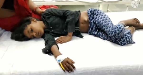 छतरपुर : खेलते समय जमीन पर गिरी 7 साल की बच्ची, पेट में घुसा लकड़ी का टुकड़ा, ऑपरेशन कर निकाला