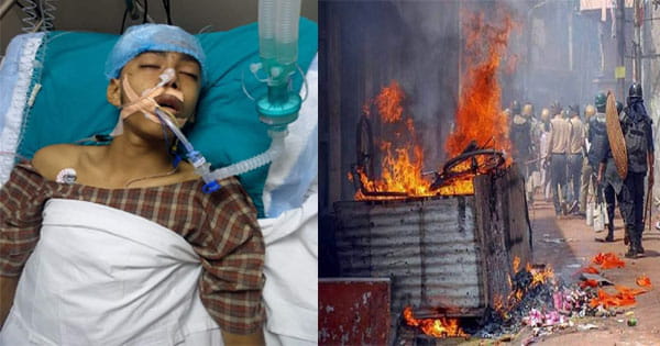 खरगोन हिंसा में घायल शिवम की हालत गंभीर, 24 घंटे बाद भी नहीं आया होश; दो दिन बाद है बहन की शादी