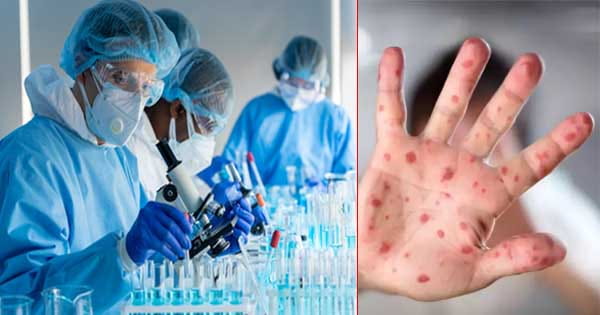 Monkeypox Alert : भारत में बढ़ा मंकीपॉक्‍स का खतरा, स्‍वास्‍थ्‍य मंत्रालय ने राज्‍यों के लिए जारी की Guidelines
