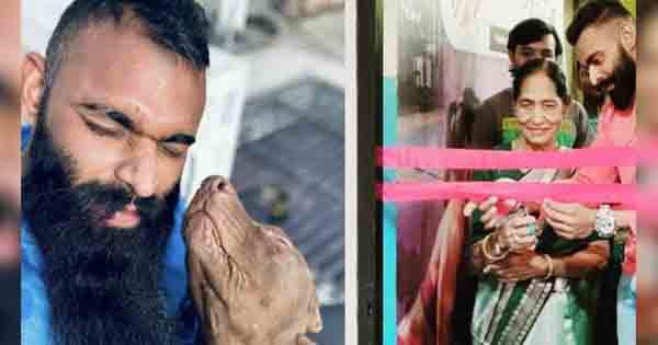 Pitbull Dog Attack: जिस कुत्ते को बच्चे की तरह पाला... वही बना मालकिन का हत्यारा, शरीर पर इतने घाव देख हैरान रह गए डॉक्टर