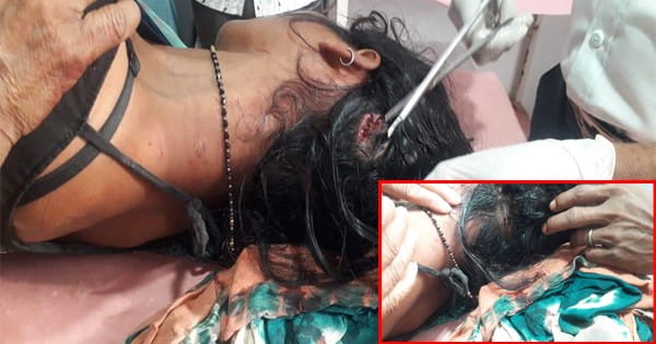 VIDEO : रायसेन में तेंदुए ने महिला पर किया जानलेवा हमला, सिर में आई गंभीर चोट