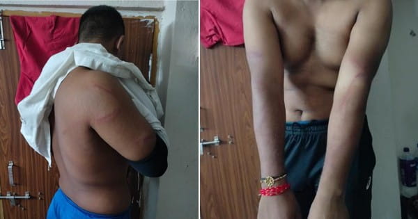 VIDEO : इंदौर के तीन फिजिकल ट्रेनर्स ने दिल्ली के छात्र के साथ की मारपीट, कहा- आगे से अगर हमारा हुकुम नहीं माना तो जान से मार देंगे