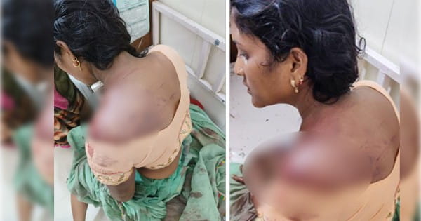 अंधविश्वास ! इलाज के नाम पर महिला को मारी तलवार, तांत्रिक बोला- तेरे शरीर में डायन है... तीन पर FIR