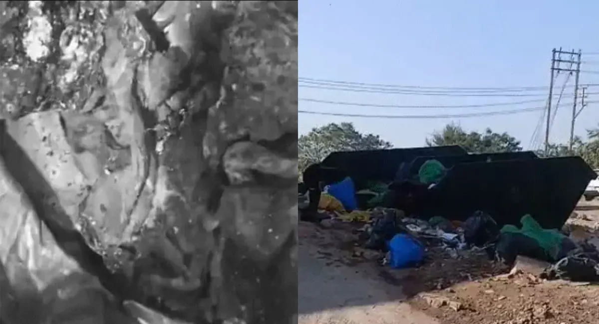 हमीदिया अस्पताल में 2 नवजातों के मिले अधजले शव, पुरानी टंकी में कचरे के साथ फेंके गए थे