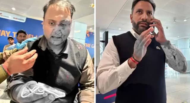 ऑफ-ड्यूटी पायलट पर FIR, हिरासत में आरोपी; पीड़ित का दावा- नाक की हड्डी टूटी