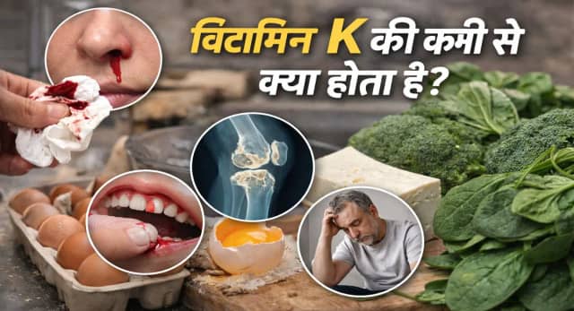 जानें क्यों शरीर के लिए जरूरी है विटामिन K