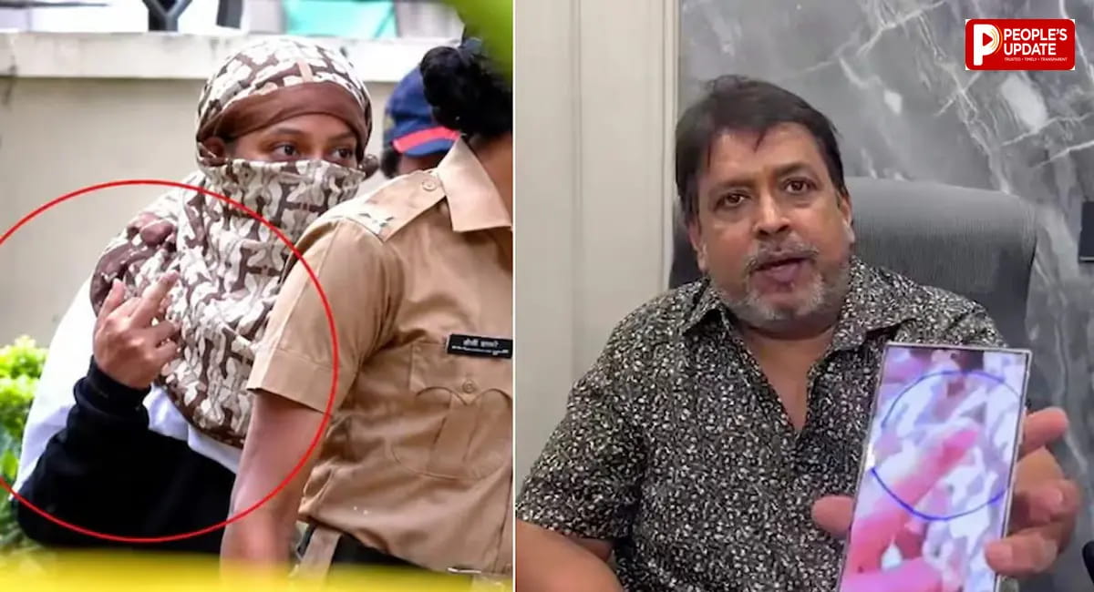 बोले- उंगलियां कार के दरवाजे में फंसी थीं, तस्वीर को गलत तरीके से दिखाया गया