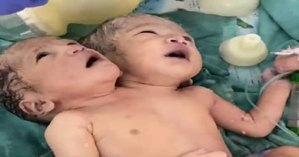 इंदौर के अस्पताल में पैदा हुआ दोसर वाला बच्चा ,वजन 2.82 किलो