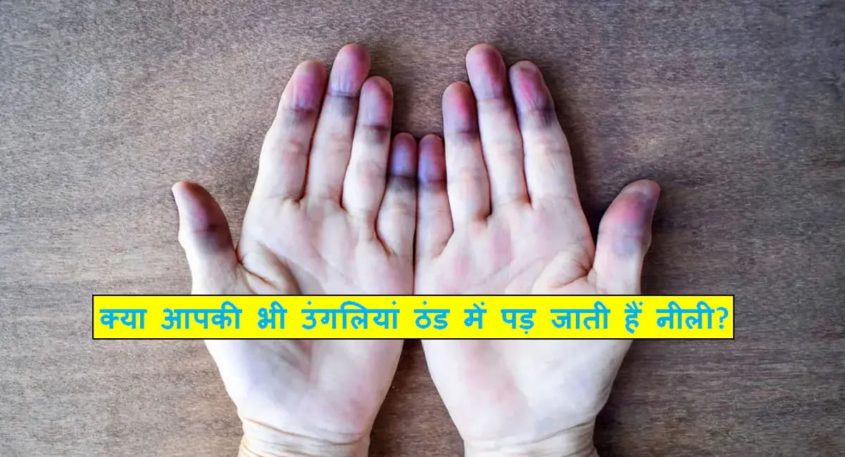 सर्दियों में उंगलियां क्यों पड़ जाती हैं नीली? जानिए रेनाड्स सिंड्रोम का सच