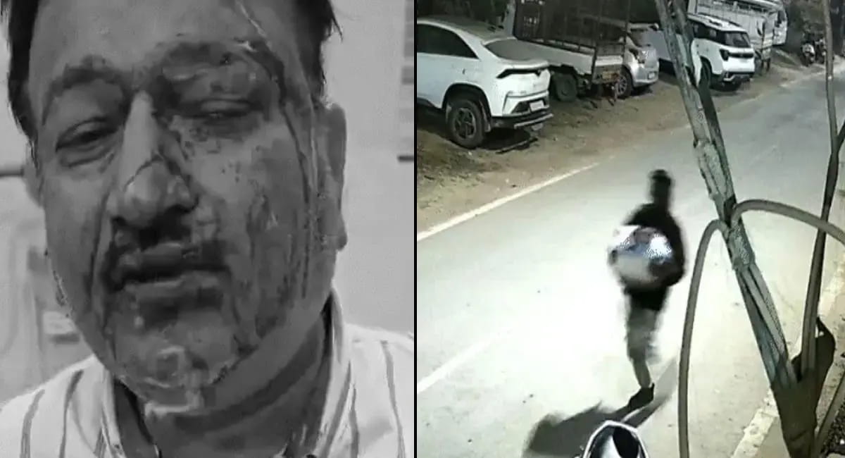 स्कूटी से घर लौट रहे व्यापारी पर हमला, आरोपी CCTV में कैद