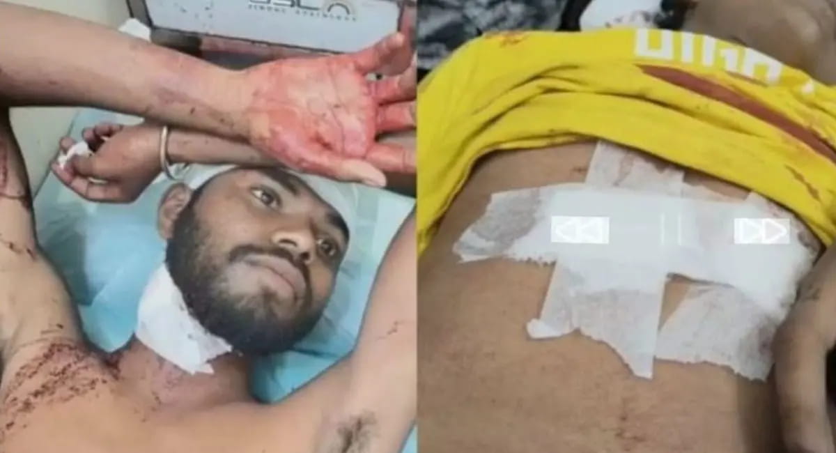 बालोद में कांग्रेस पार्षद पर चाकू से हमला, दो आरोपी गिरफ्तार