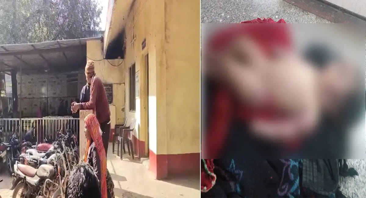 आग में झुलसी 5 महीने की बच्ची, लटेरी से गुना तक न एम्बुलेंस मिली, न समय पर इलाज