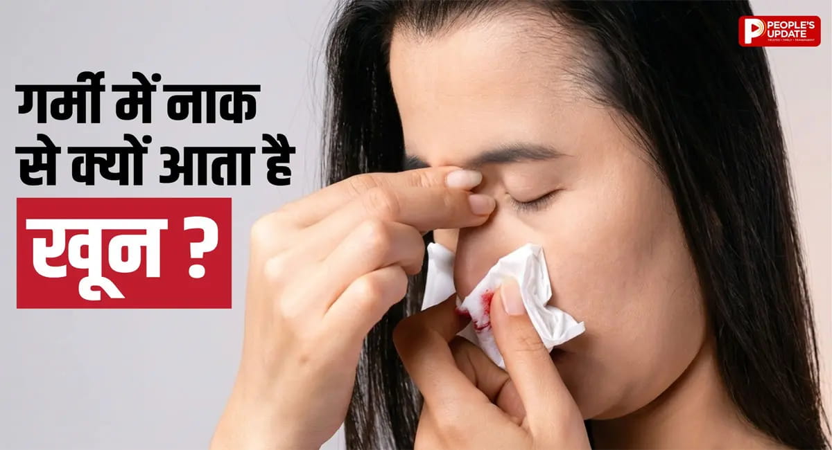 नकसीर को न करें नजरअंदाज, जानिए कारण और बचाव के तरीके