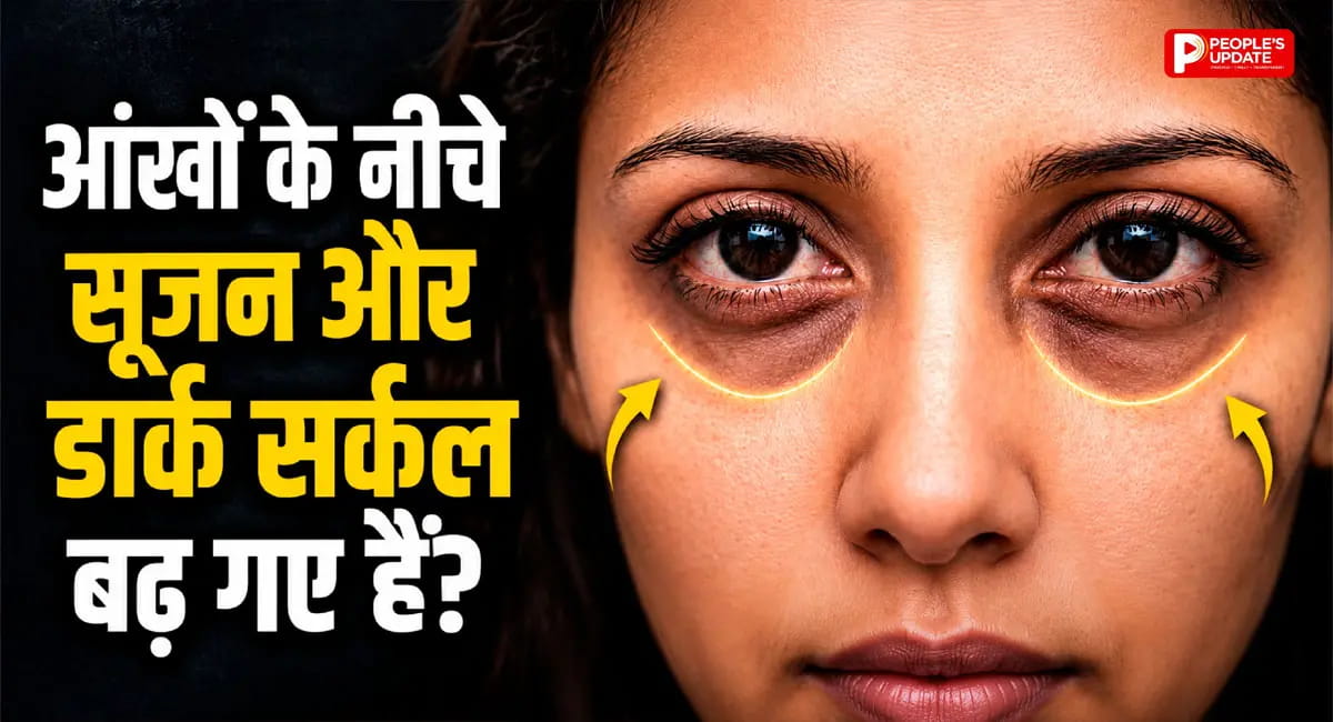 नींद पूरी फिर भी डार्क सर्कल्स? चेहरा दे रहा गंभीर बीमारी का संकेत, जानिए असली कारण