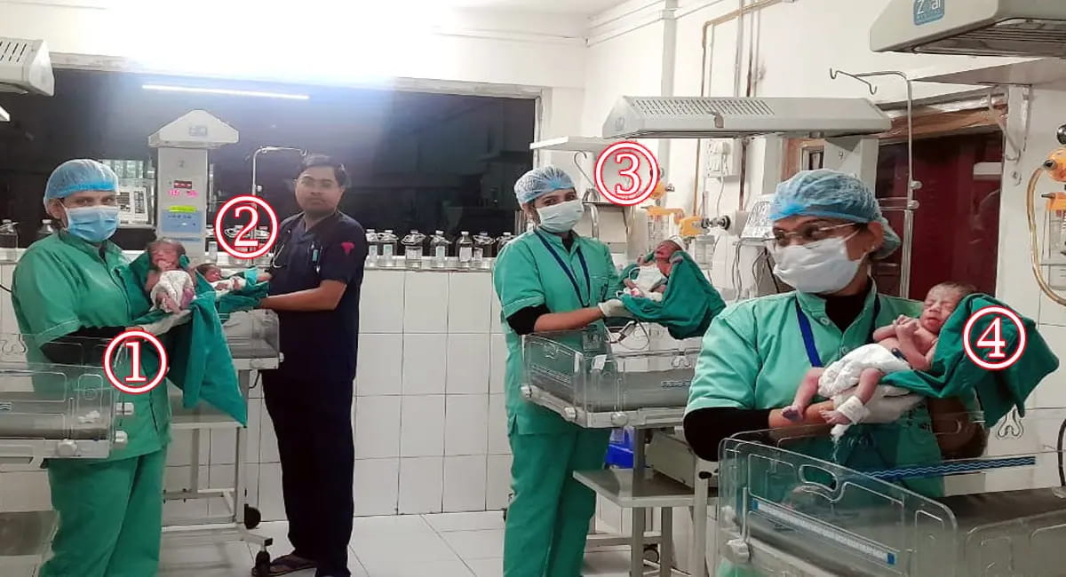 इंदौर में एक साथ चार बच्चों का जन्म, तीन लडक़ी और एक लडक़ा