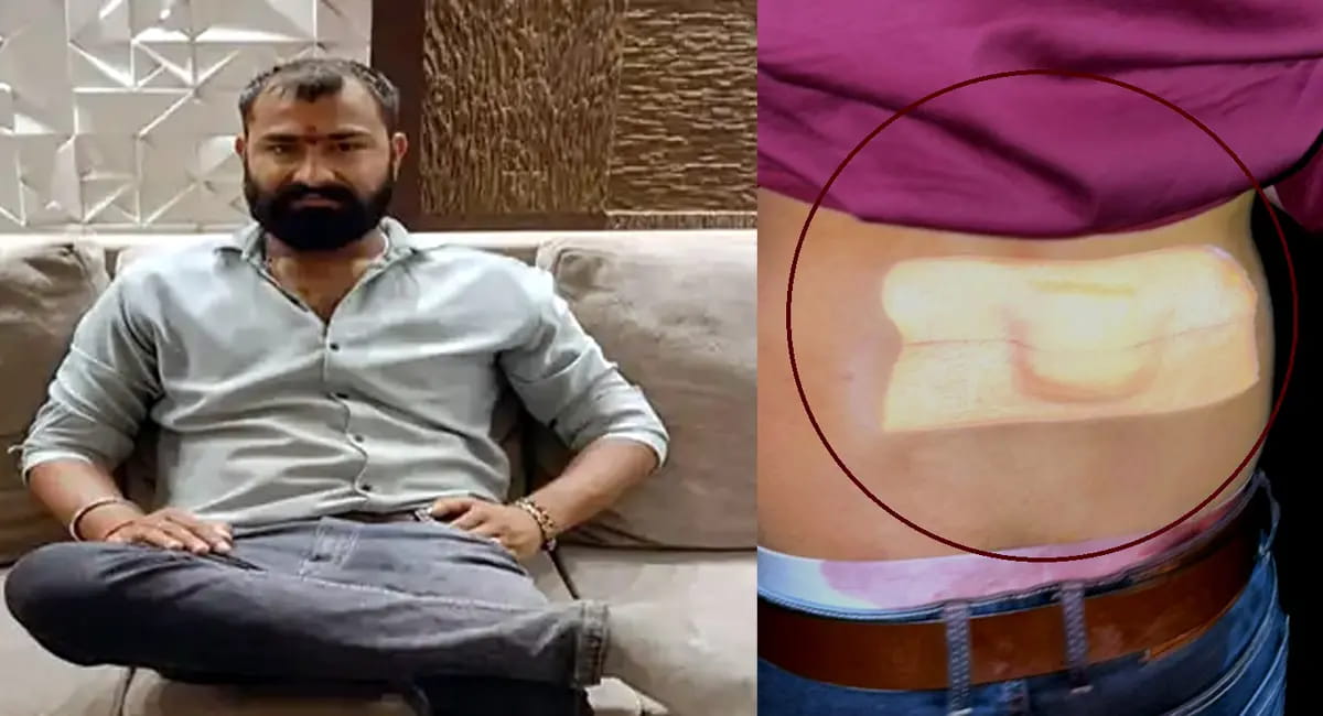 आर्बिट मॉल के पास बीयर बोतल से हत्या : टकराने की बात पर खूनी झड़प, युवक की मौत
