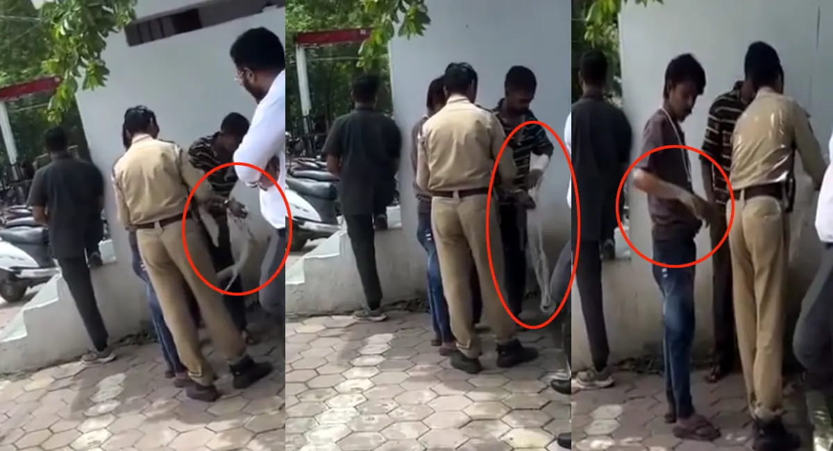 बदमाशों के नकली प्लास्टर ने पुलिस की खोली पोल